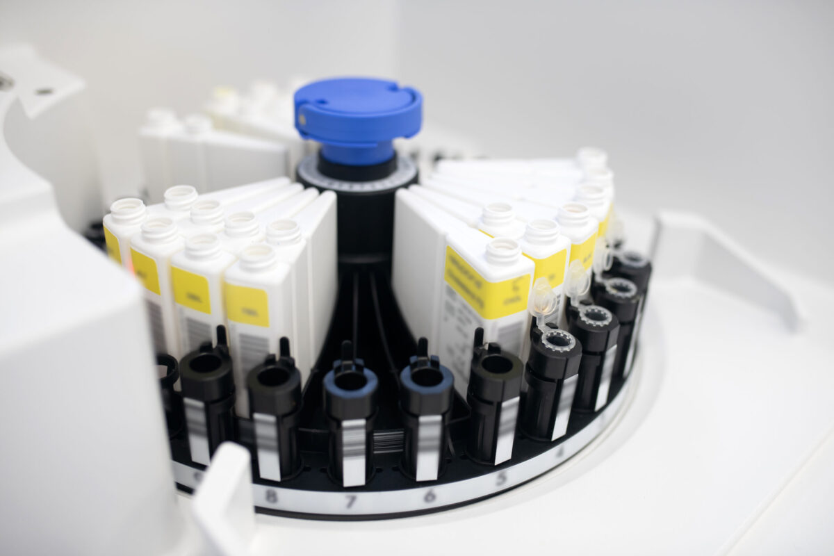 Markerii tumorali: Ce sunt și pentru ce se folosesc?